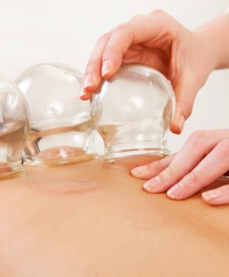 Detail of an acupuncture therapist removing a glass globe in a fire cupping procedure